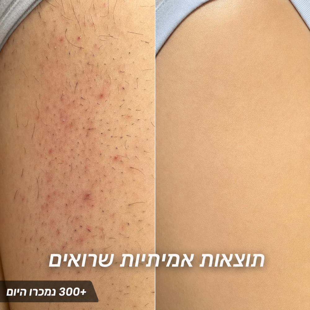 הסוף לגילוח יומיומי: שמן מעכב צמיחה
