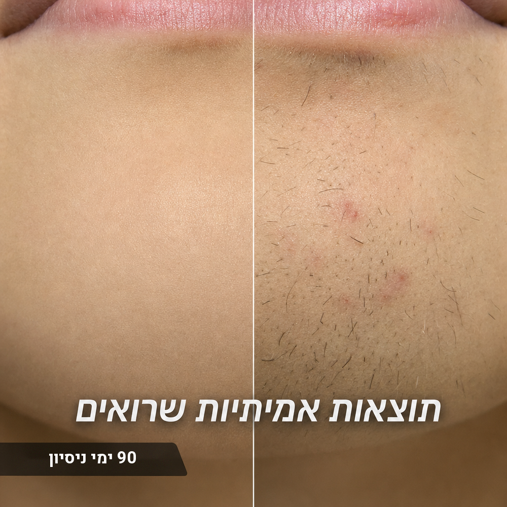 הסוף לפינצטה בסנטר: שמן מעכב צמיחה