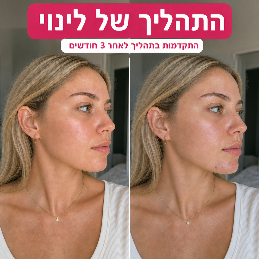 הסוף לפינצטה בסנטר: שמן מעכב צמיחה