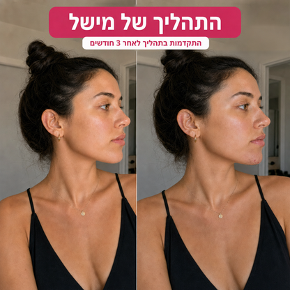 הסוף לפינצטה בסנטר: שמן מעכב צמיחה